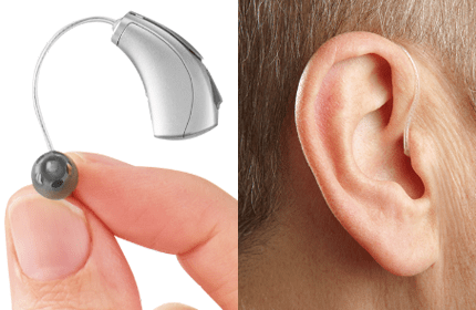 Tinnitus